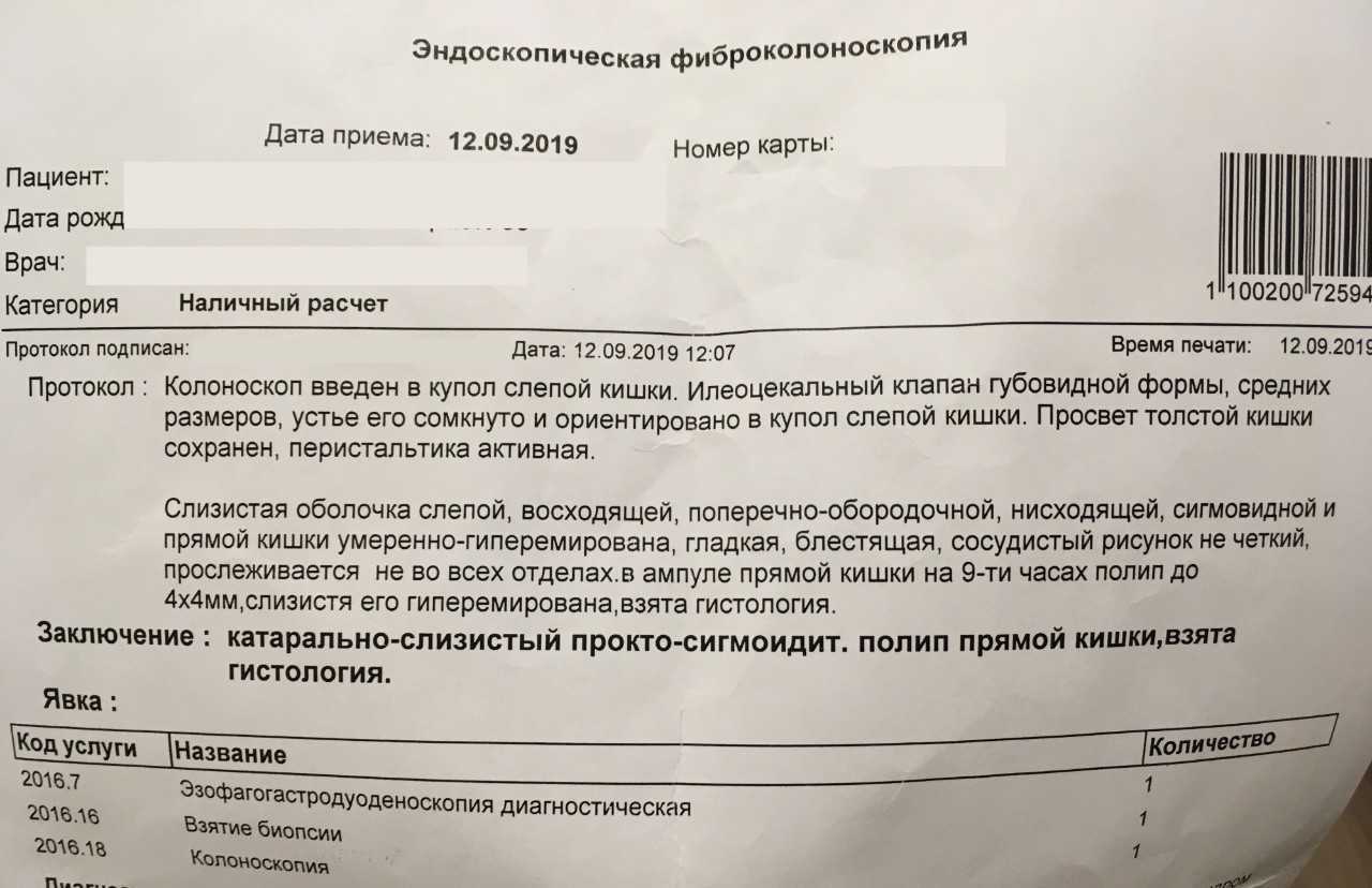 Что такое фкс?