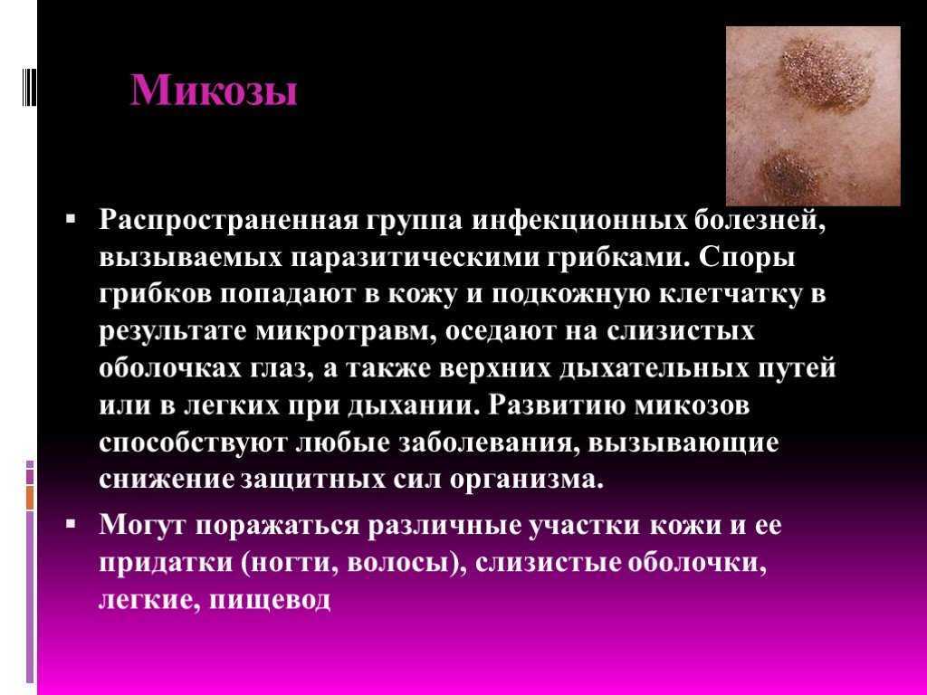Ногти
