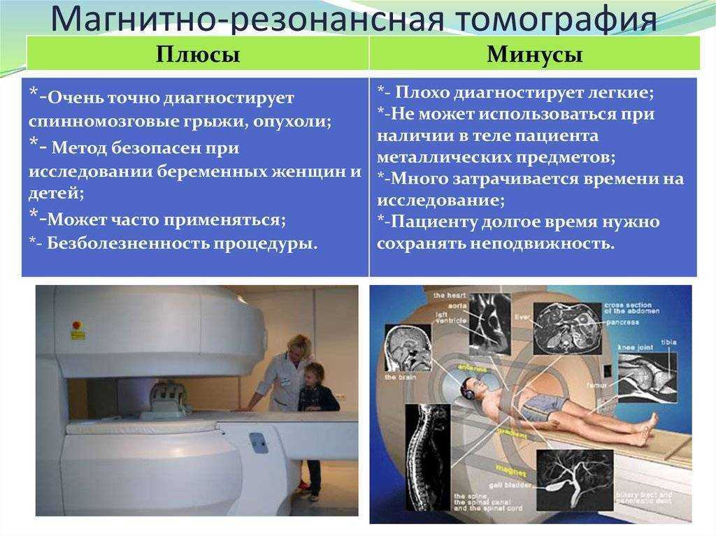 Мрт в стоматологии презентация