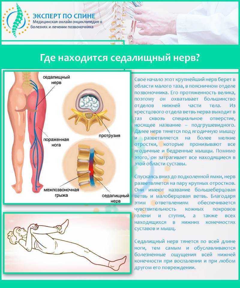 Лечение корешкового синдрома поясничного и шейного отдела позвоночника