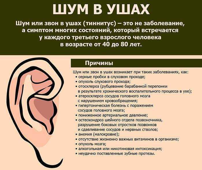 Появляется при ряде заболеваний уха, характеризующихся определенными симптомами, например снижением слуха, нарушением координации движений и признаками, обнаружение которых и позволяет выяснить причину его возникновения