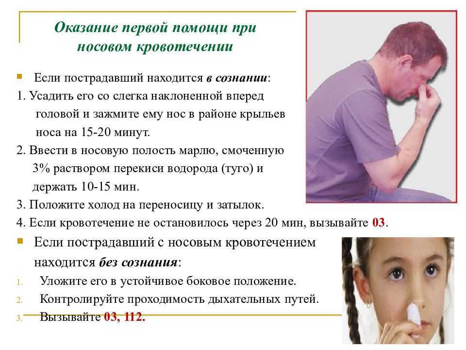 Перелом костей носа