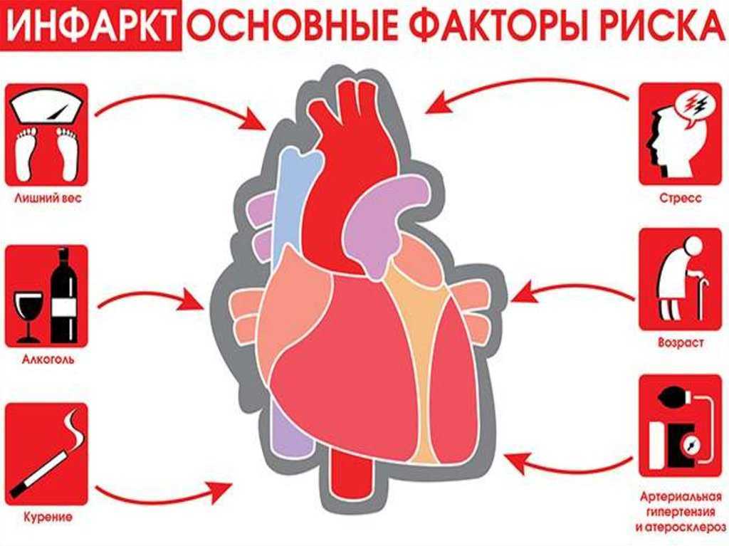 Инфаркт причины симптомы. Профилактика инфаркта миокарда. Профилактика инфаркта миокарда памятка.