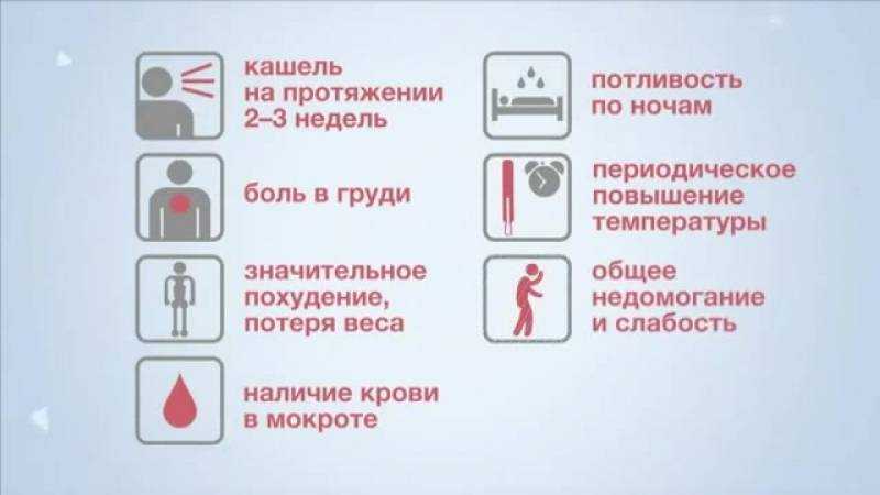 Рентген при туберкулезе легких