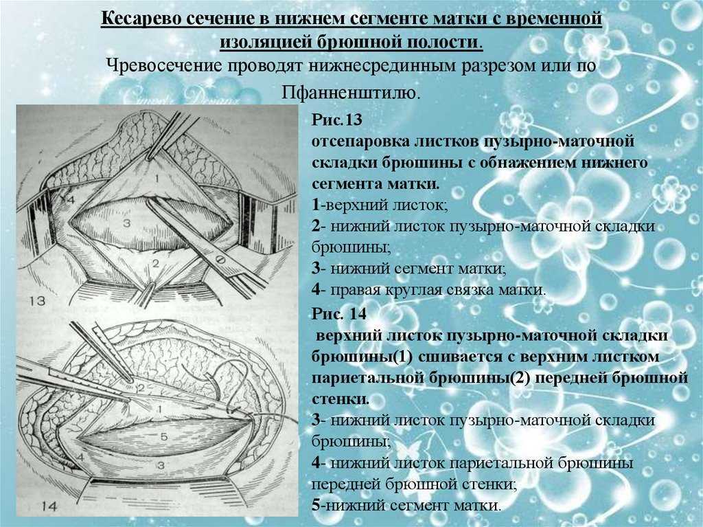 Послеоперационная реабилитация - физиоцентр