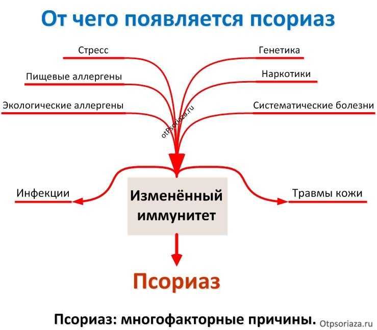 Псориаз что это причины у взрослых и лечение препараты у женщин фото