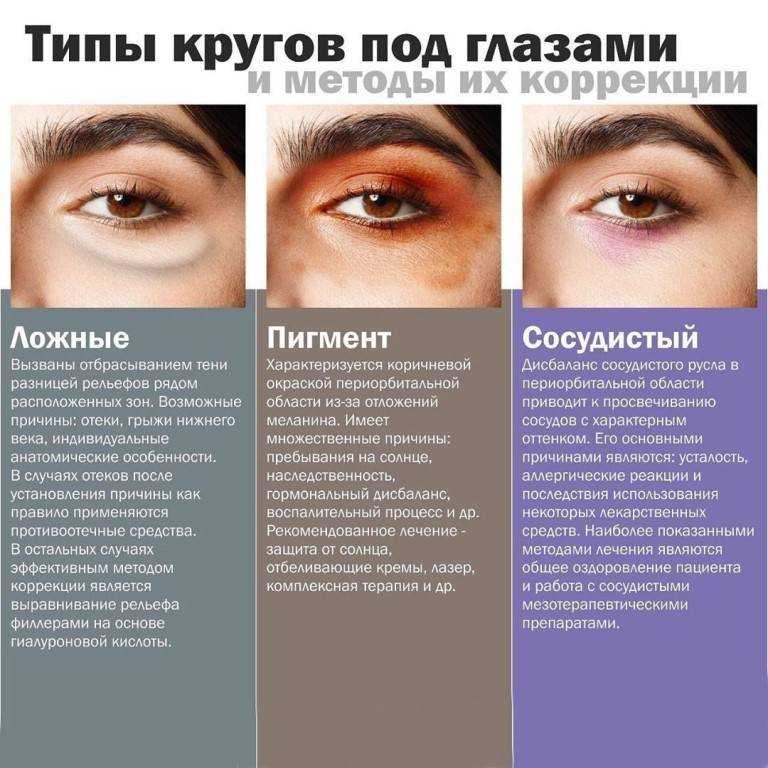 Тёмные круги и синяки под глазами - причины возникновения и методы коррекции.