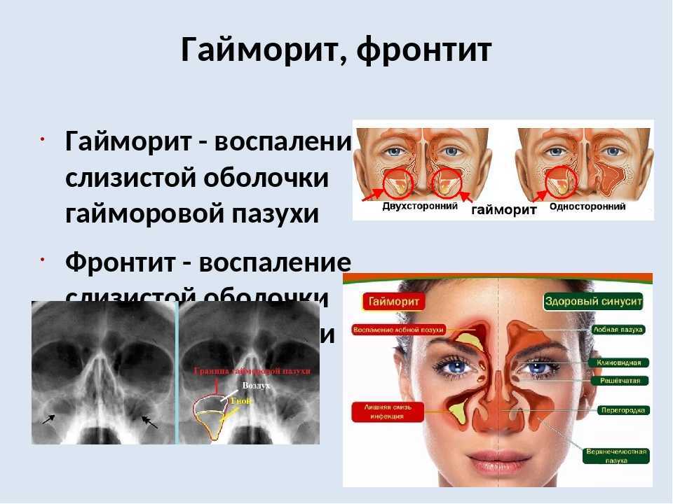 Психосоматические заболевания