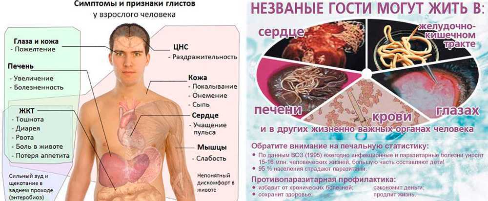 Глистные инвазии: диагностика, симптомы, причины и лечение у врача-колопроктолога в мкц «проксима» (г. сочи)
