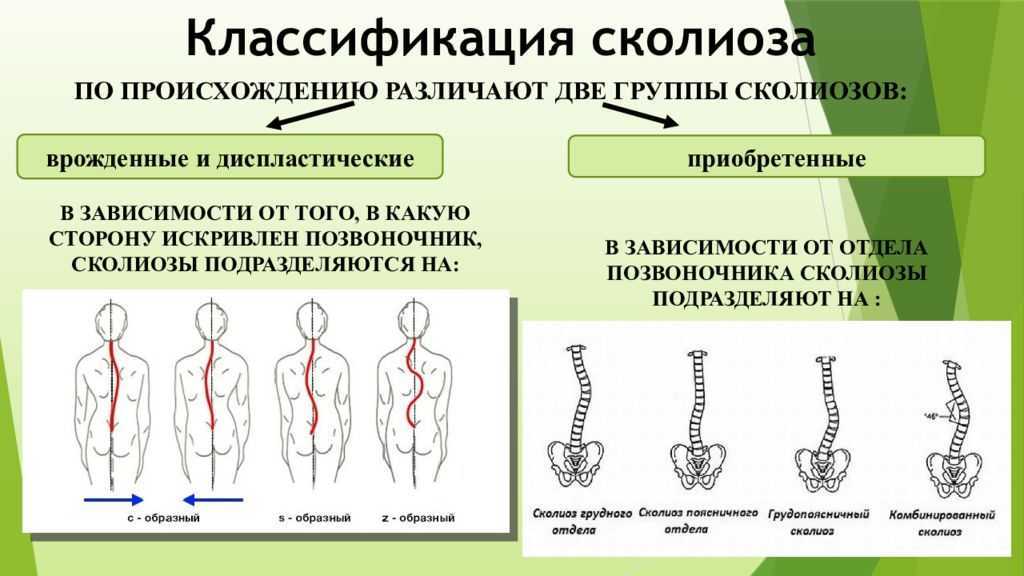 Что такое остеопороз позвоночника и как его лечить