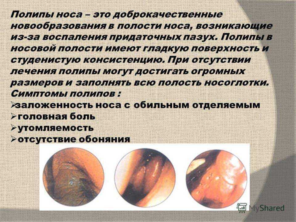 Рак железы: фото, диагноз, признаки и симптомы рака груди на разных стадиях рмж.