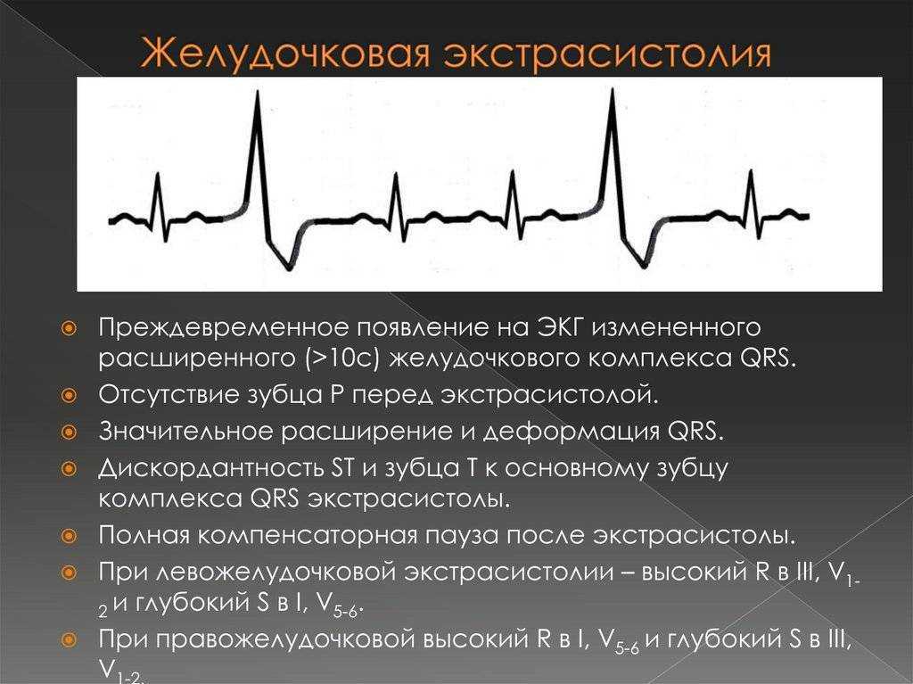 ᐈ гипертрофия левого желудочка: симптомы и диагностика ~【киев】