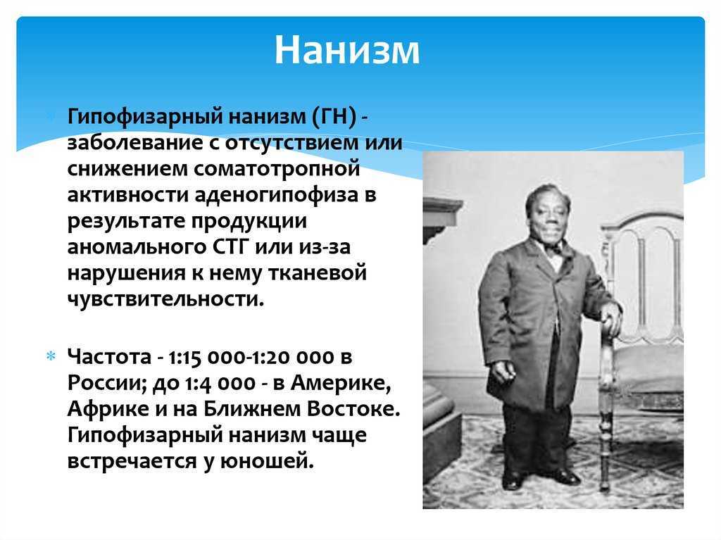 Гипофизарный нанизм (карликовость) - причины, симптомы, эффективное лечение :: polismed.com