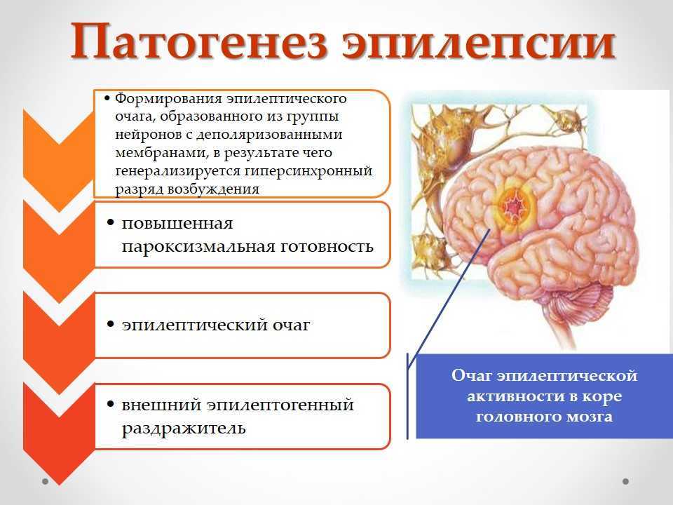 Клиническая картина эпилептического припадка