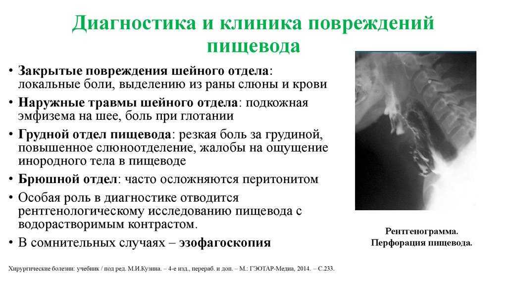 Заболевания пищевода. виды, диагностика и лечение.!