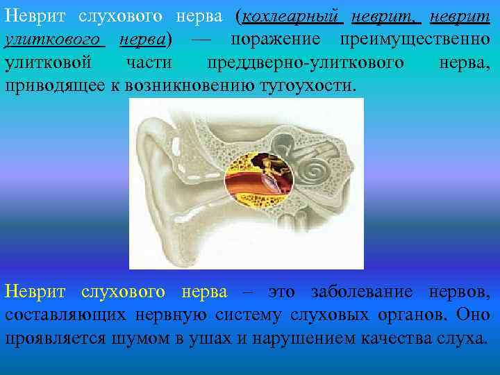 Острый средний отит и современные особенности его клиники, диагностики и лечения