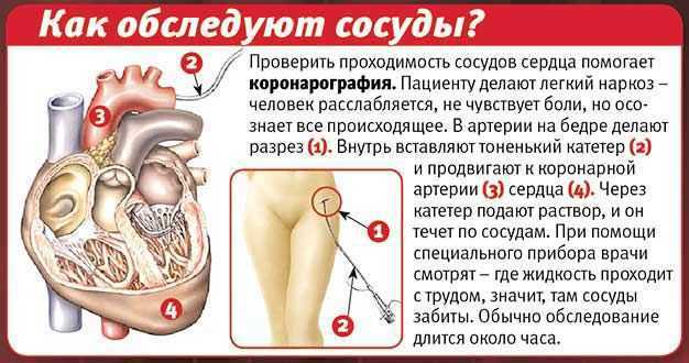 Ранняя диагностика сердечно-сосудистых заболеваний: исследования и анализы