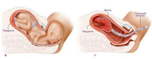 Можно достать до матки. Третий период родов Последовый. Последовый период родов рождение плаценты.
