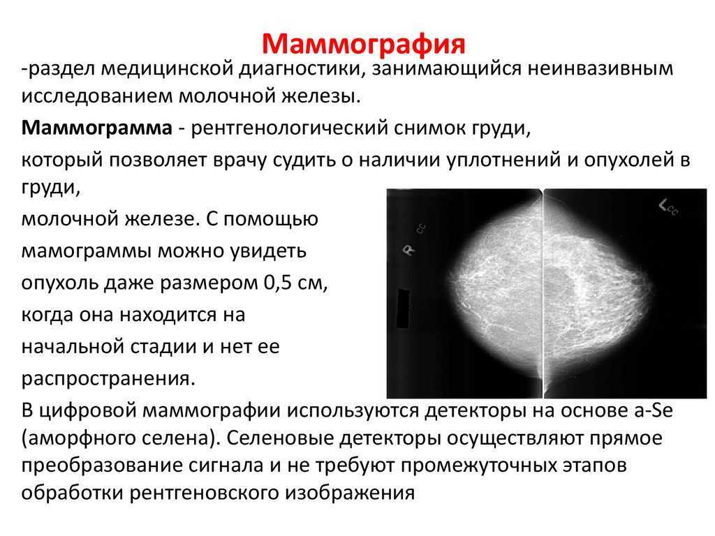 Маммография при раке молочной железы и для профилактики.