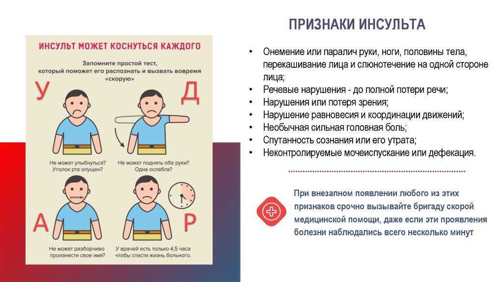 Как предотвратить инсульт?