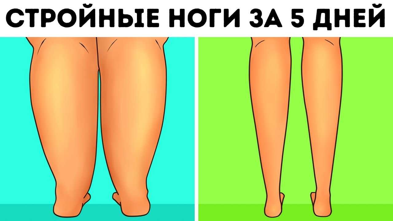 Как похудеть в икрах ног: чтобы похудели голени за короткий промежуток времени в домашних условиях, как сделать худыми девушке?