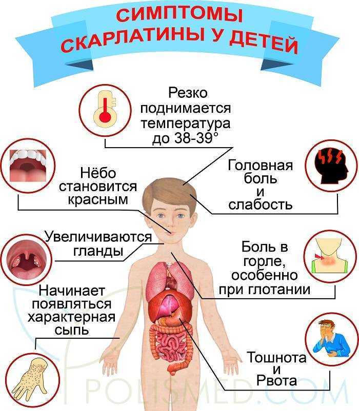 Скарлатина: основные признаки заболевания. как протекает скарлатина. лечение скарлатины