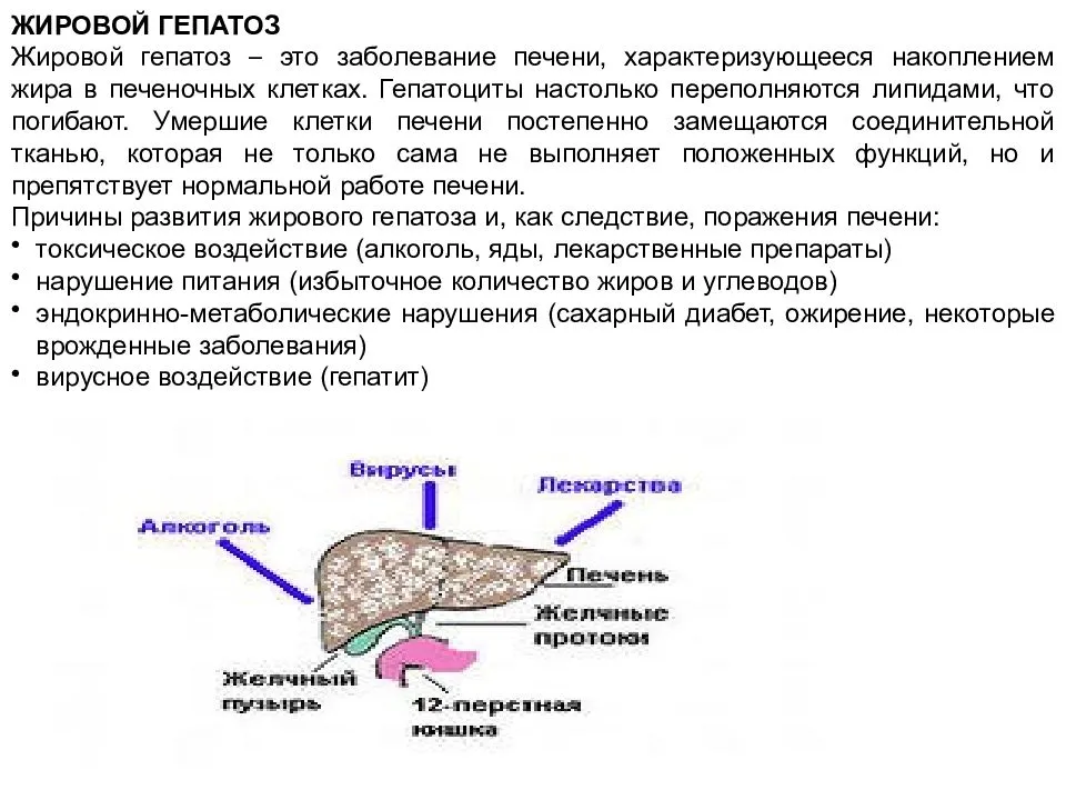 Метод печени. Жировой гепатоз печени симптомы. Жировой гепатоз печени симптомы и причины развития заболевания. Жировой гепатоз симптомы. Воспалительные поражения печени называются.