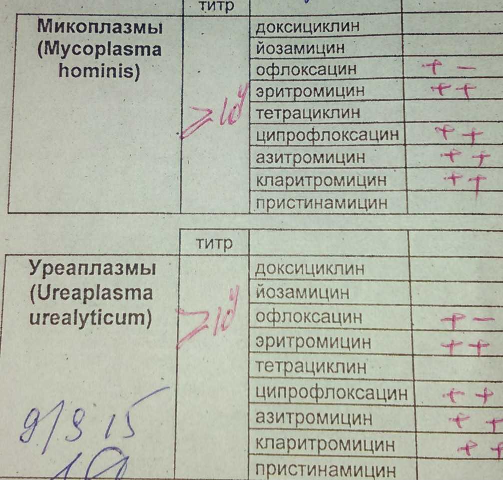 Mycoplasma hominis у мужчин