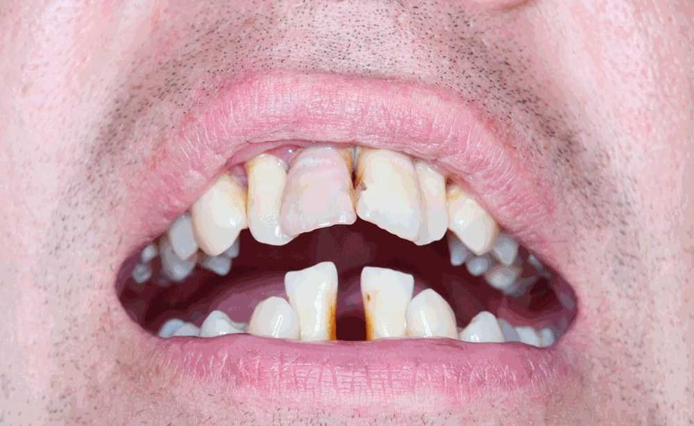К чему снятся зубы: страшно или все в порядке?