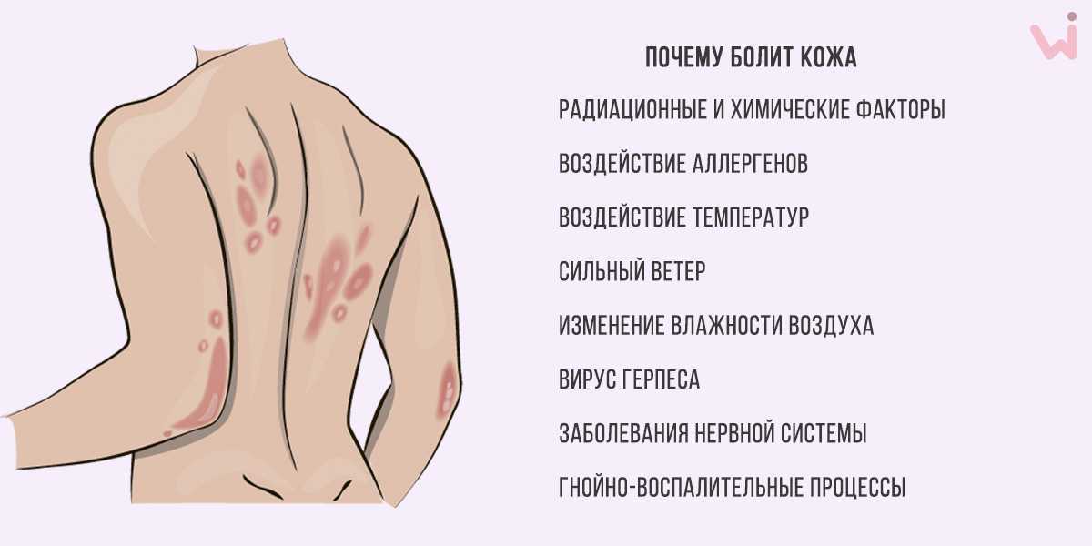 Ретикулярный варикоз