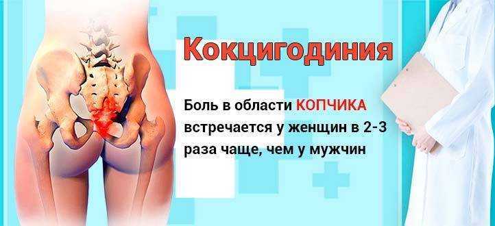 Кокцигодиния или боль в области копчика
