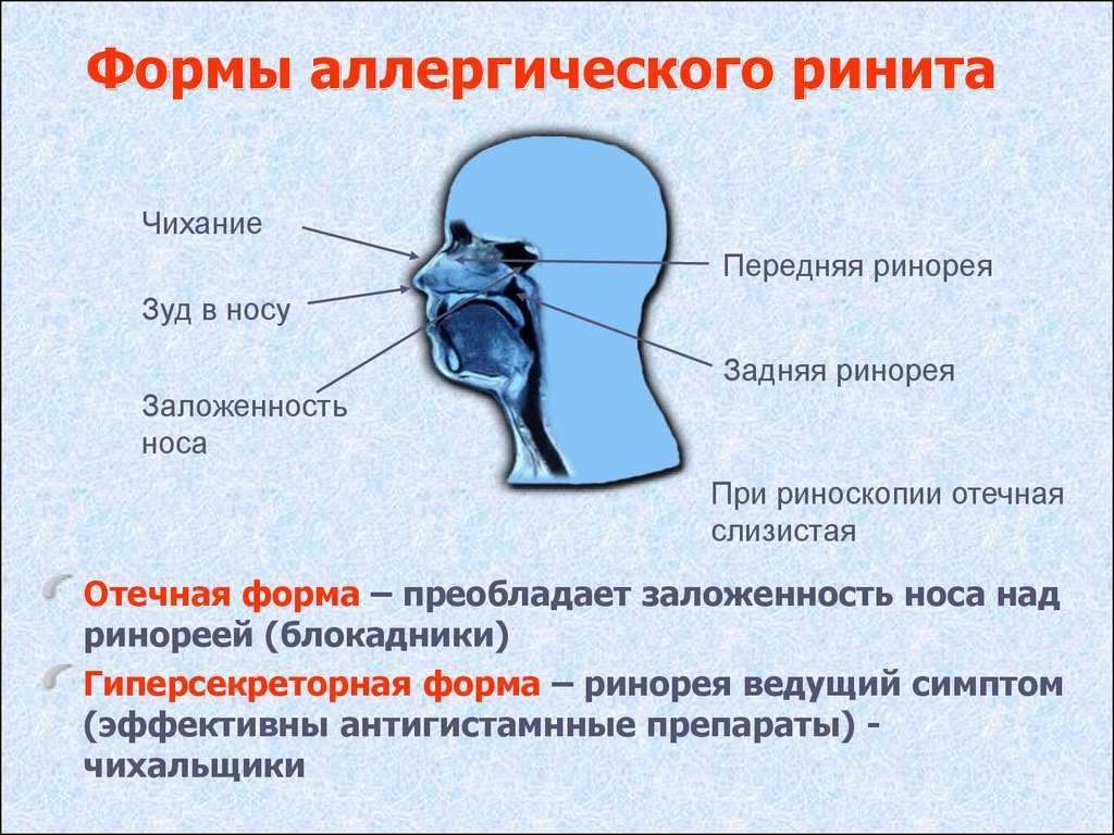 Затруднённое носовое дыхание. почему не дышит нос, виды заложенности носа и лечение